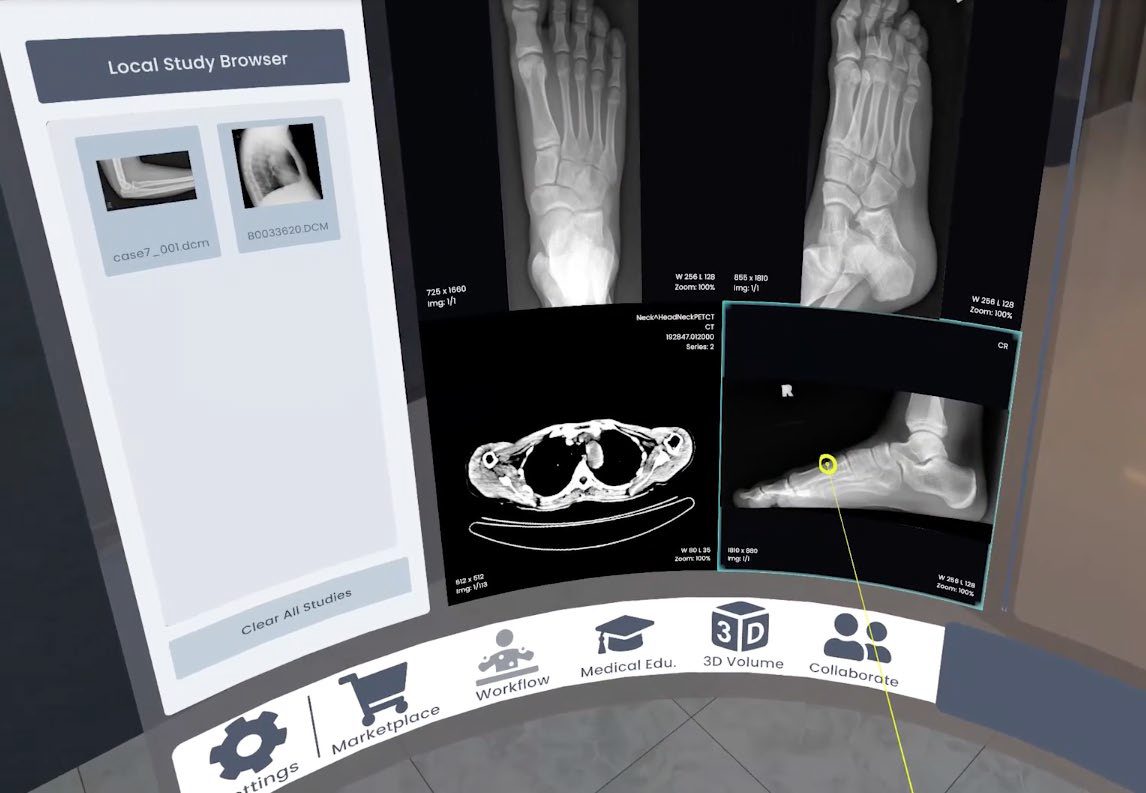 VR and XR in Medical Training_ Luxsonic.jpg