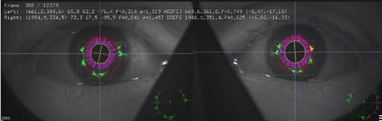 眼动追踪.jpg 眼动追踪.jpg